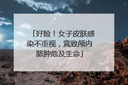 好险！女子皮肤感染不重视，竟致颅内脓肿危及生命